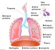 Keuhkoputket: mitä ja miten ne ovat, toiminta, tulehdus