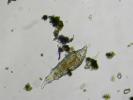 Zooplankton: what it is, examples, food and phytoplankton