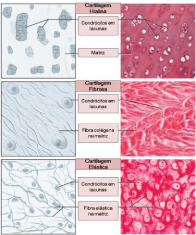 Cartilaginous Tissue or Cartilage: function and characteristics